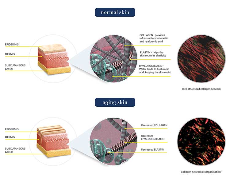 Normal Skin versus Ageing Skin